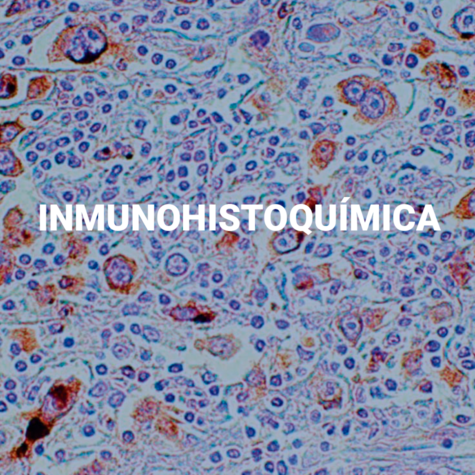 INMUNOHISTOQUIMICA