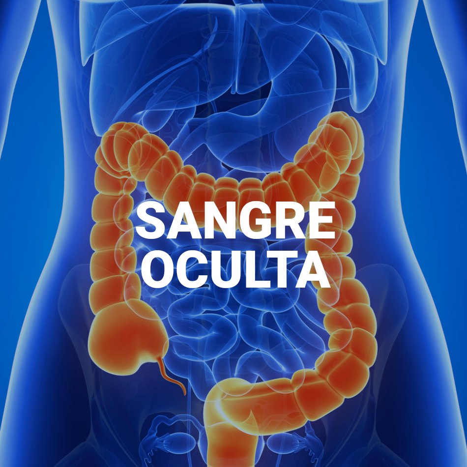 SANGRE OCULTA