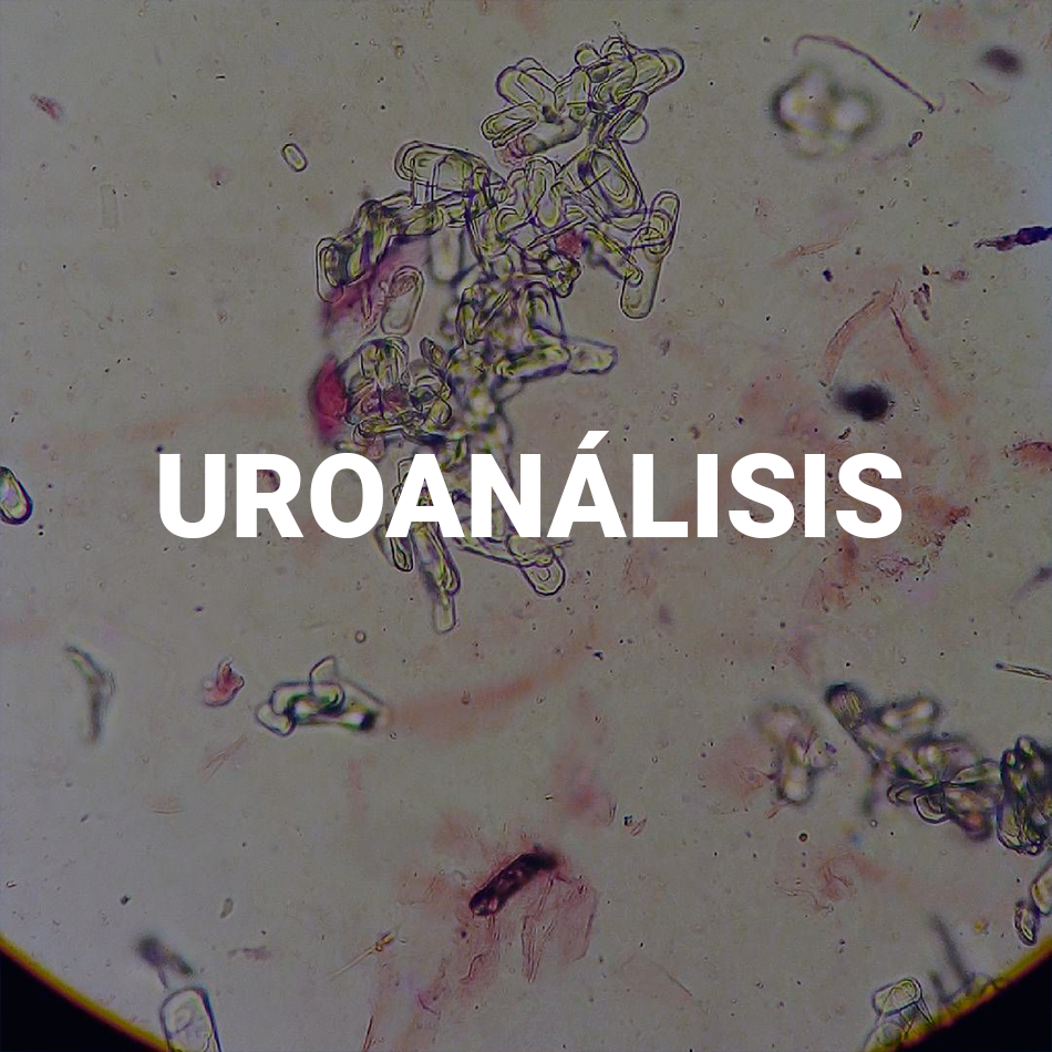 UROANALISIS