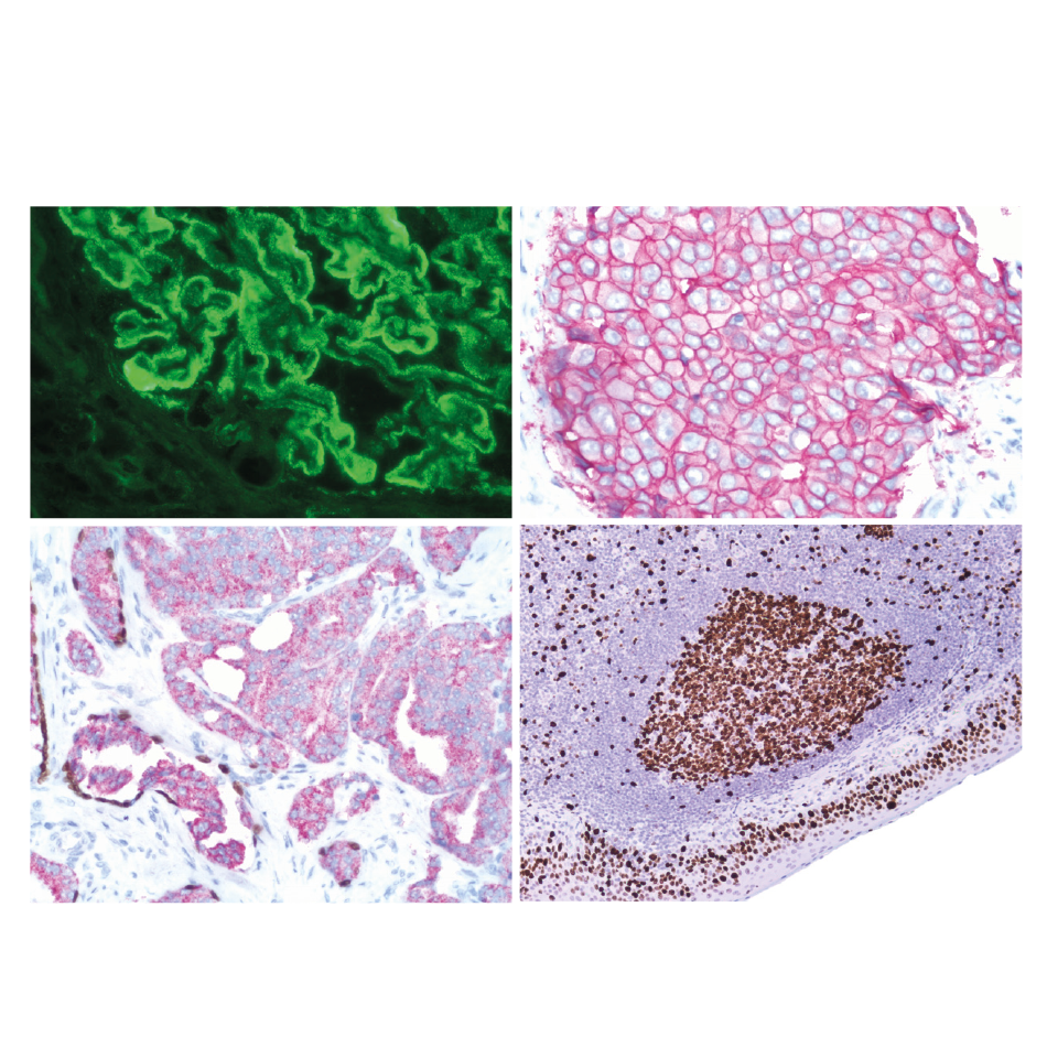 vitro stainer _4