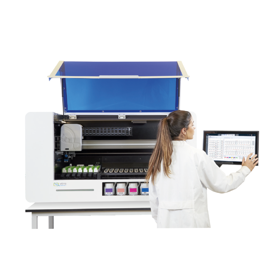 vitro stainer_2